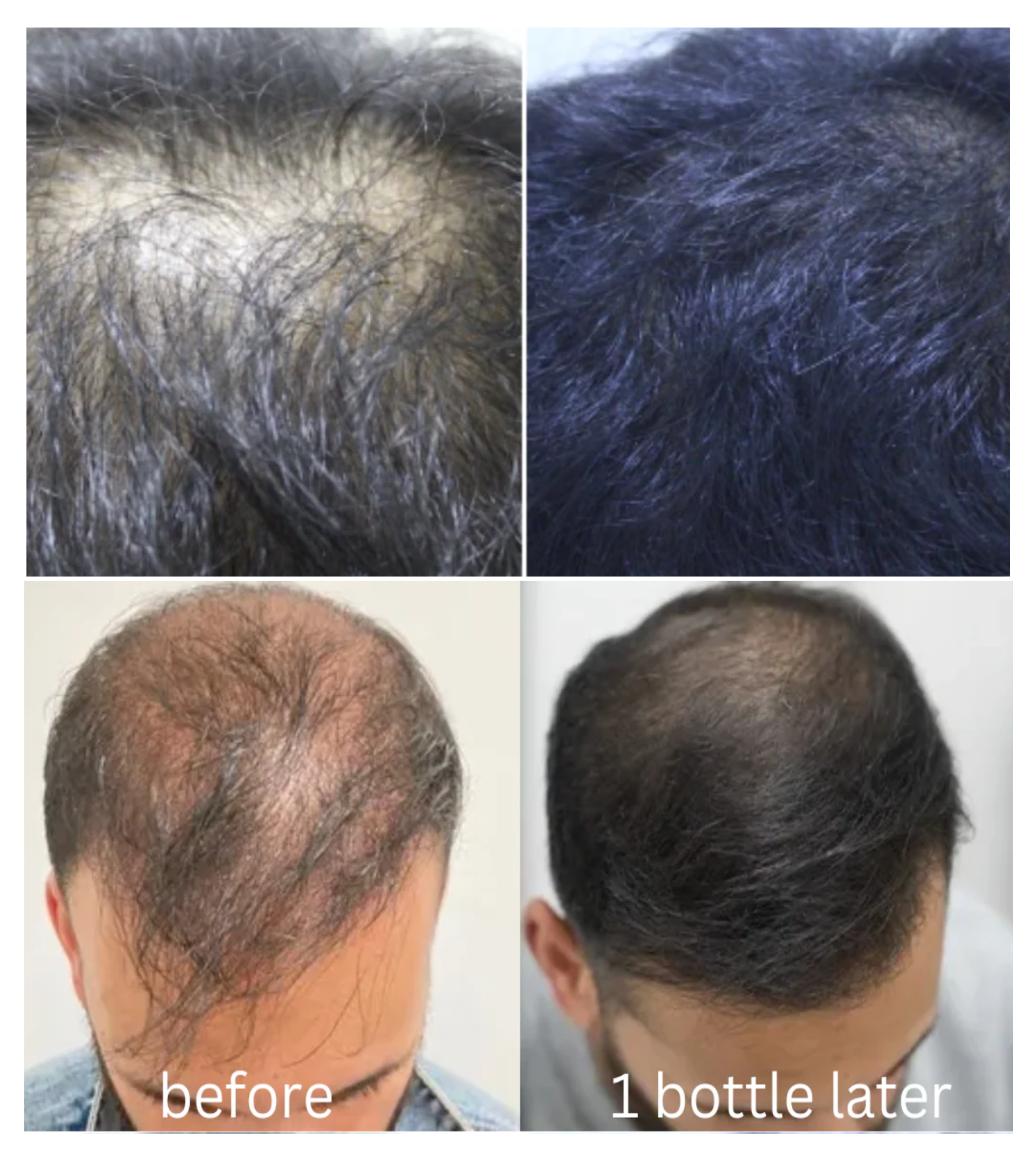Glowixo Premium Herbal Hair Oil female hair growth comparison showing before, after 1 month, after 2 months and after 3 months of regular use. Hair appears fuller, thicker and healthier.