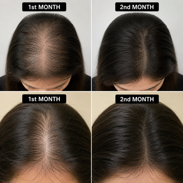 Glowixo Premium Herbal Hair Oil female hair growth comparison showing before, after 1 month, after 2 months and after 3 months of regular use. Hair appears fuller, thicker and healthier.
