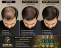 Glowixo Premium Herbal Hair Oil female hair growth comparison showing before, after 1 month, after 2 months and after 3 months of regular use. Hair appears fuller, thicker and healthier.