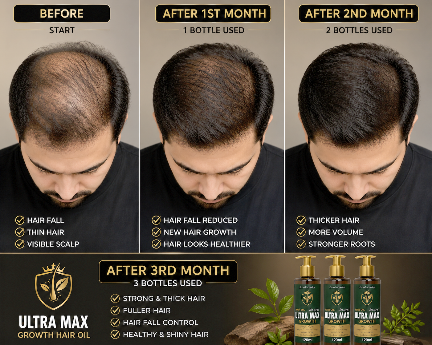 Glowixo Premium Herbal Hair Oil female hair growth comparison showing before, after 1 month, after 2 months and after 3 months of regular use. Hair appears fuller, thicker and healthier.