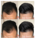 Glowixo Premium Herbal Hair Oil female hair growth comparison showing before, after 1 month, after 2 months and after 3 months of regular use. Hair appears fuller, thicker and healthier.