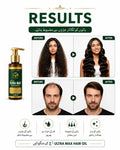 Baalon Ki Mazbooti Ke Liye Herbal Oil | Glowixo Glowixo.store