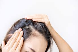 HAIR REGROWTH